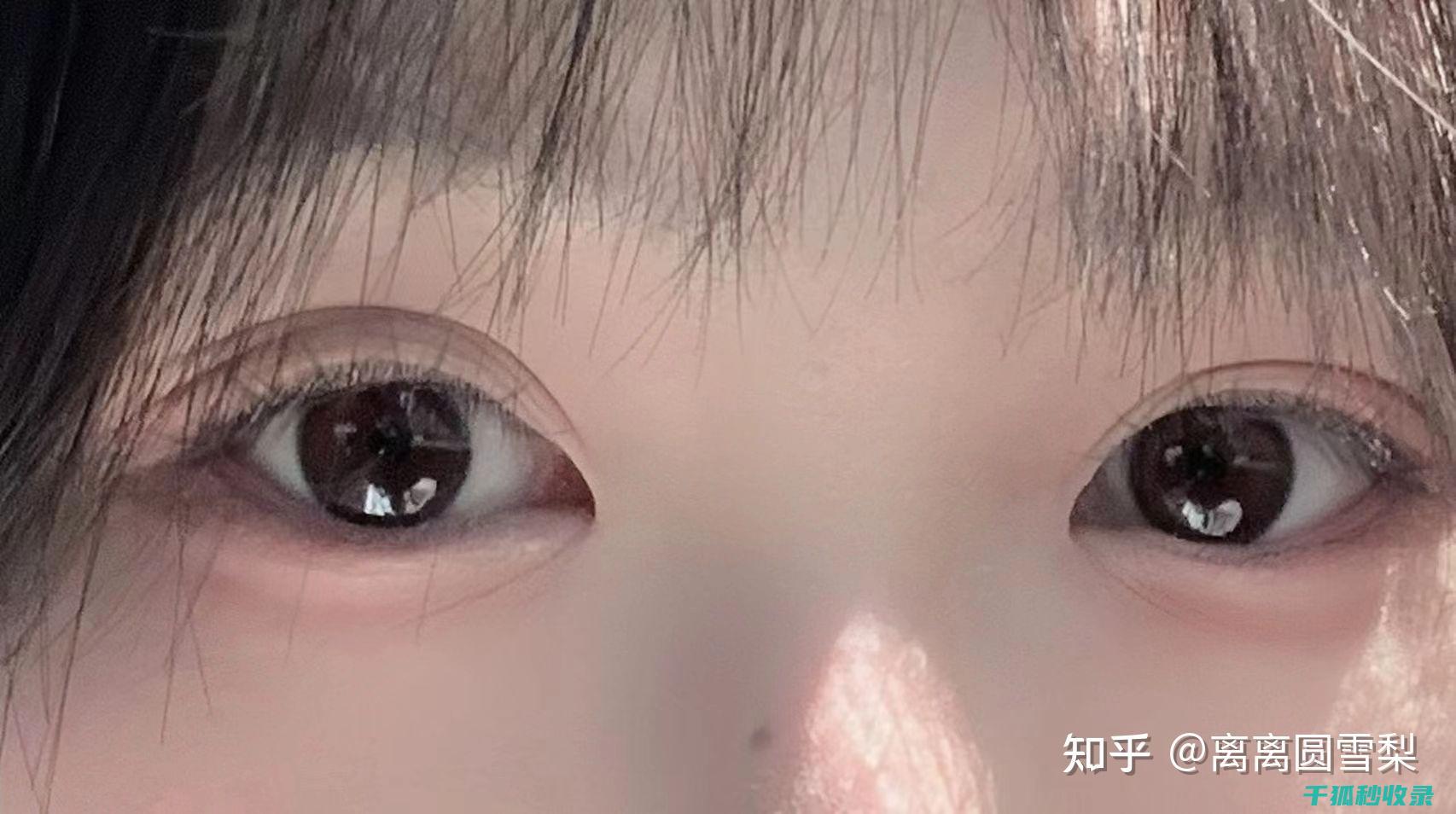 长时间用眼后有异物感